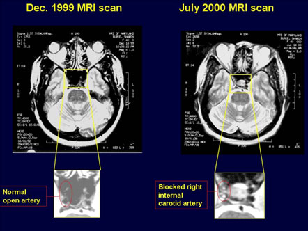 CT Scan Comparison